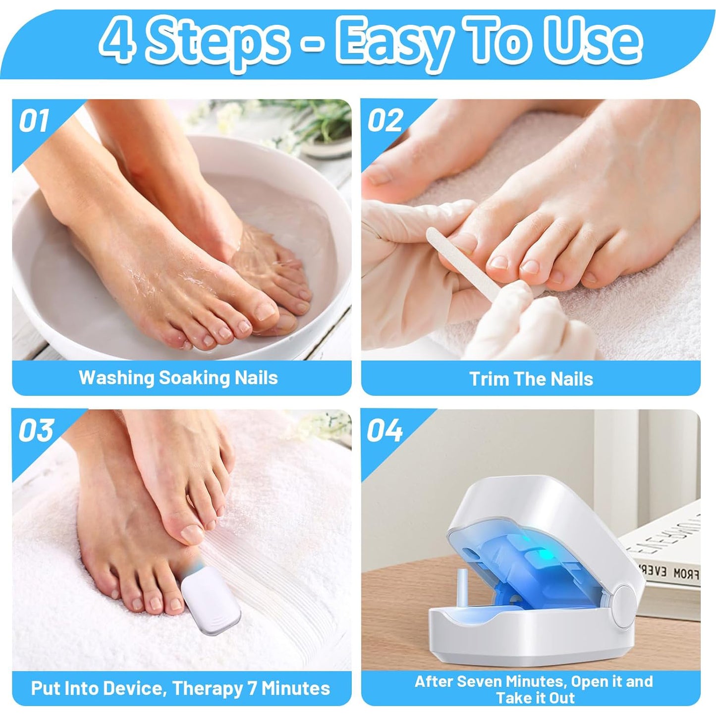 12915 Rechargeable Nail Fungus Treatment For Toenail Toe Nail Fungal Treatment Nail Fungus Laser Device Anti-fungal Nail Treatment For Hand Feet Infections Remover For Home Use