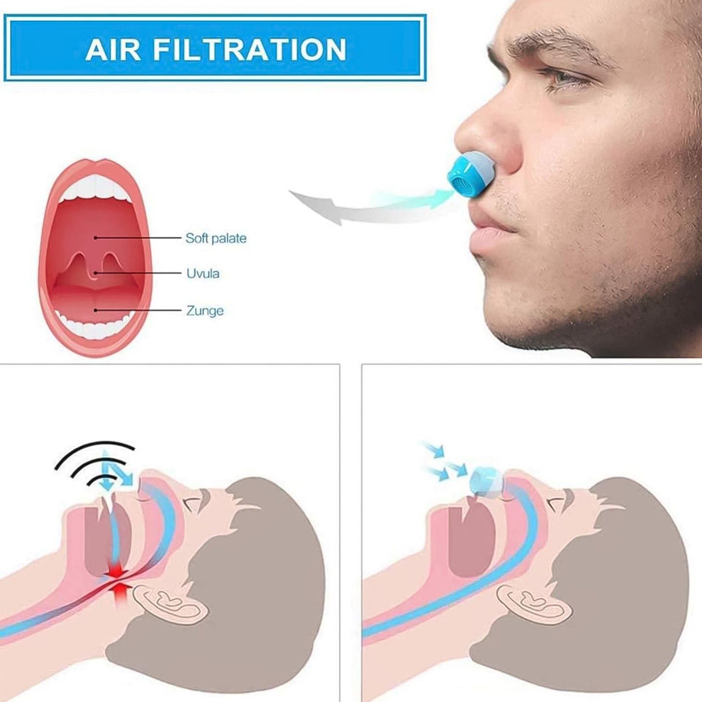 2 In 1 Anti Snoring And Air Purifier Nose Clip Anti Snoring Device (1 Pc With Plastic Case)