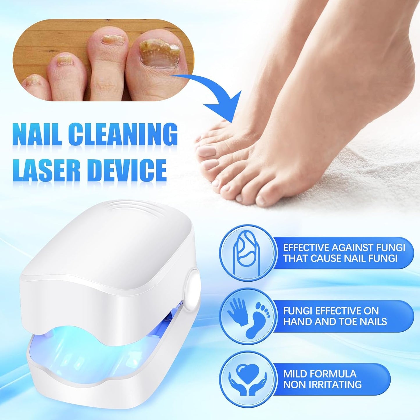 Rechargeable Nail Fungus Laser Ã¢â‚¬â€œ Anti-Fungal Device for Toenails, Hands & Feet (Home Use)