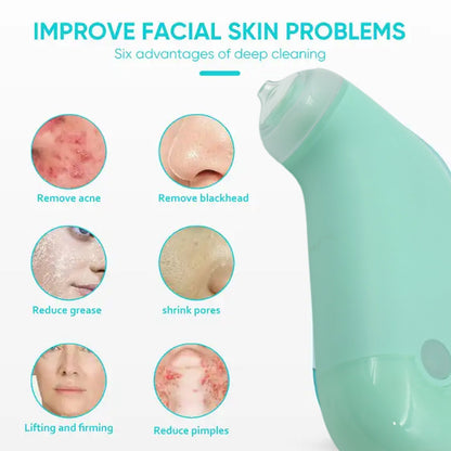 Mini Handheld Vacuum Blackhead Remover Ã¢â‚¬â€œ Facial Massage & Spot Lifting (1 Pc)