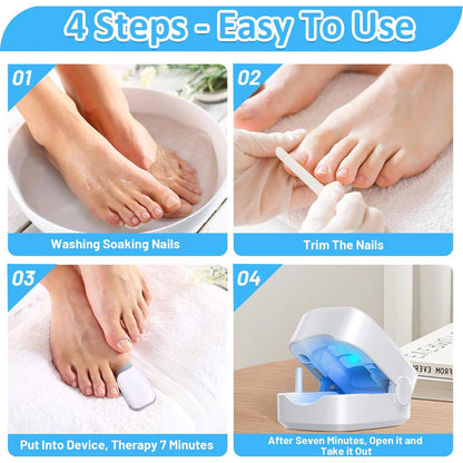 Rechargeable Nail Fungus Laser Ã¢â‚¬â€œ Anti-Fungal Device for Toenails, Hands & Feet (Home Use)