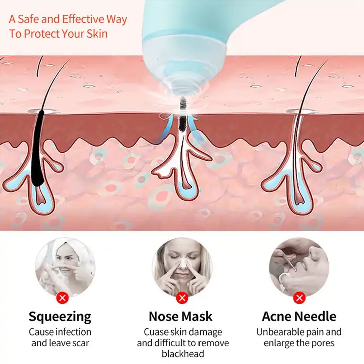 Mini Handheld Vacuum Blackhead Remover Ã¢â‚¬â€œ Facial Massage & Spot Lifting (1 Pc)